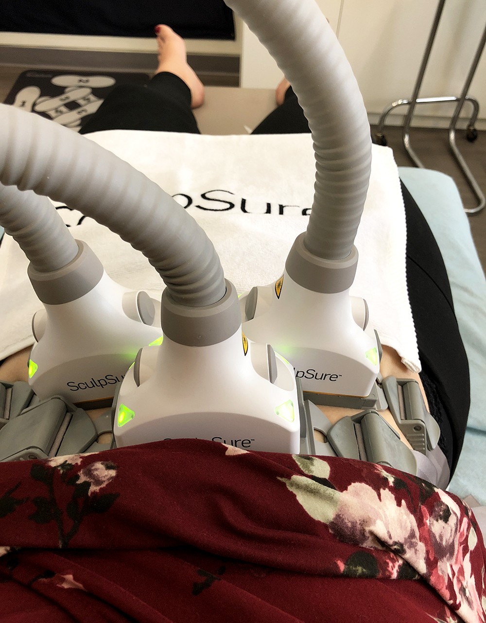 Upper Abdomen - My Second SculpSure Body Contouring Treatment at LaserXX - Wedding Prep featured by popular Los Angeles beauty blogger My Beauty Bunny 